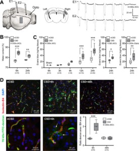 Spreading depolarizations trigger caveolin-1-dependent endothelial transcytosis