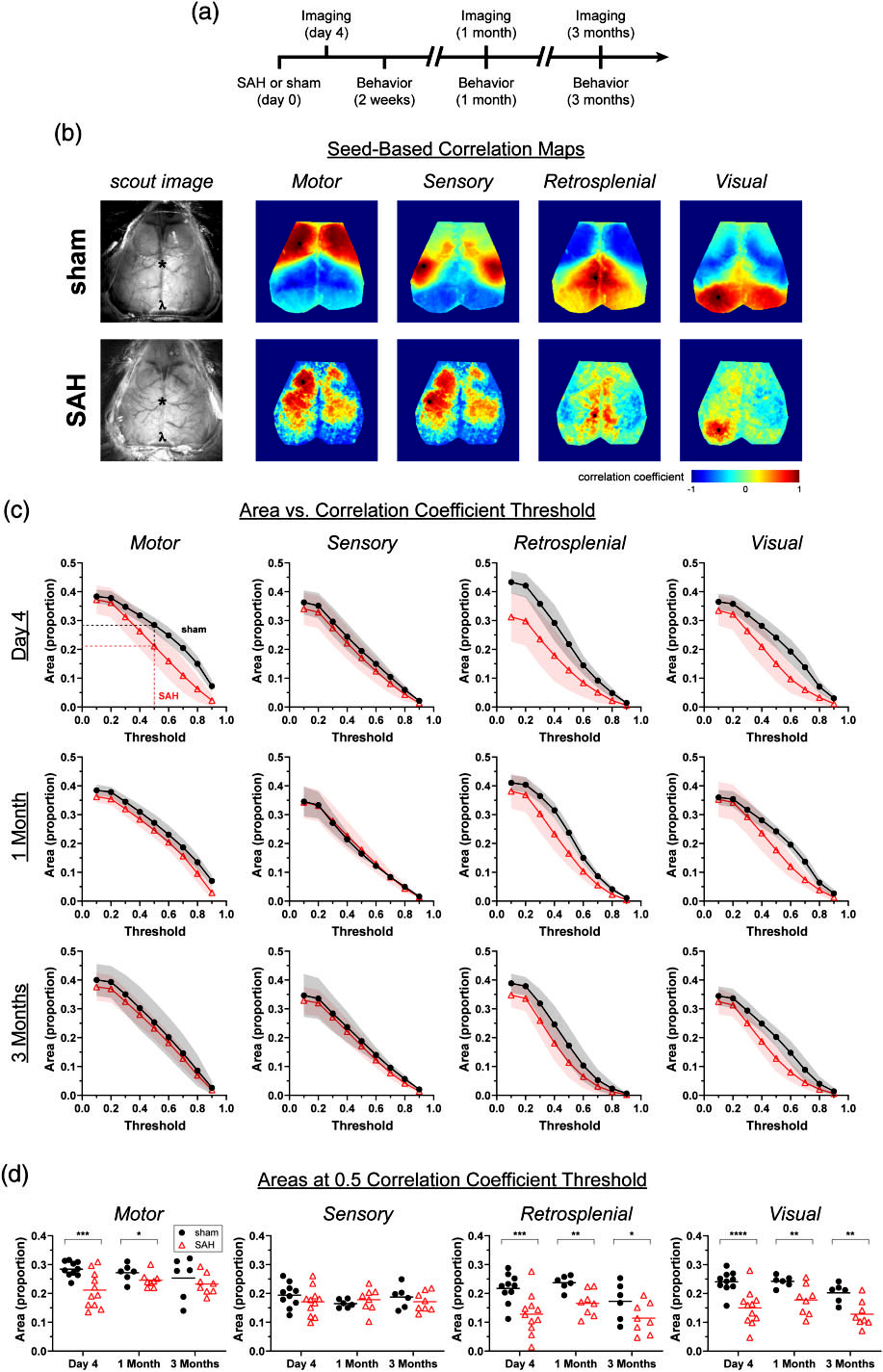 Subarachnoid Hemorrhage - Neurovascular Research Unit